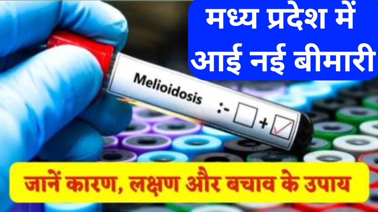मध्य प्रदेश में आई एक नई बीमारी जाने कारण लक्षण और उपचार