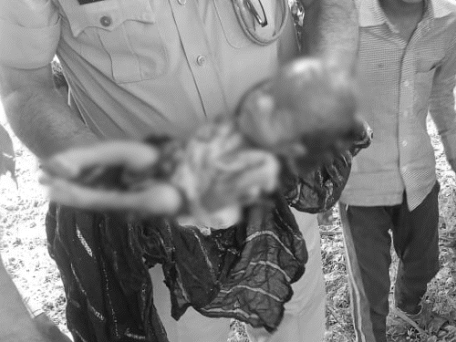 15 दिन की बच्ची को जिंदा दफन किया